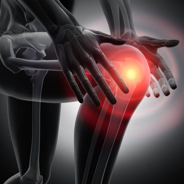 Top 5 Mistakes After Knee Replacement Surgery What You Need To Know Indian Insight 360 3116